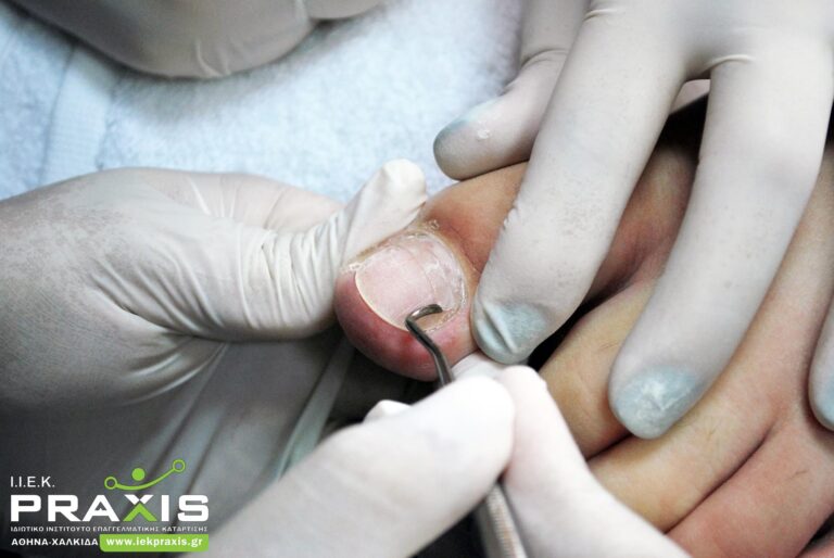 Ποδολογία και Θεραπευτικό Πεντικιούρ